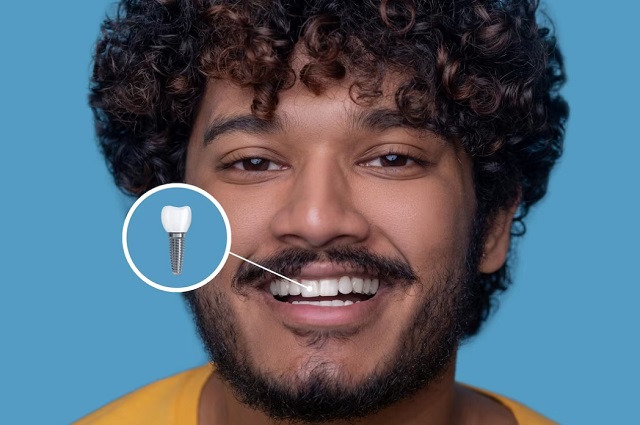 implant-nedir