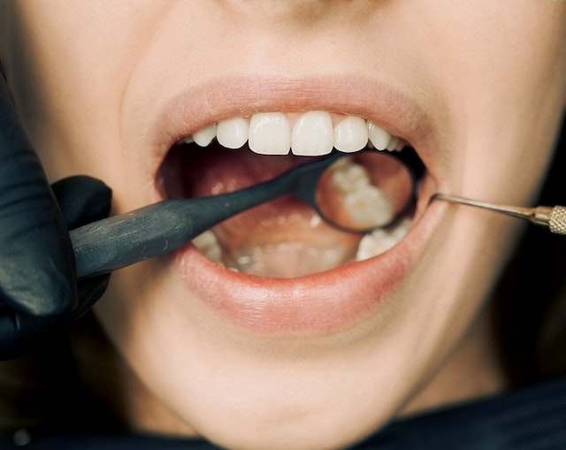 periodonti