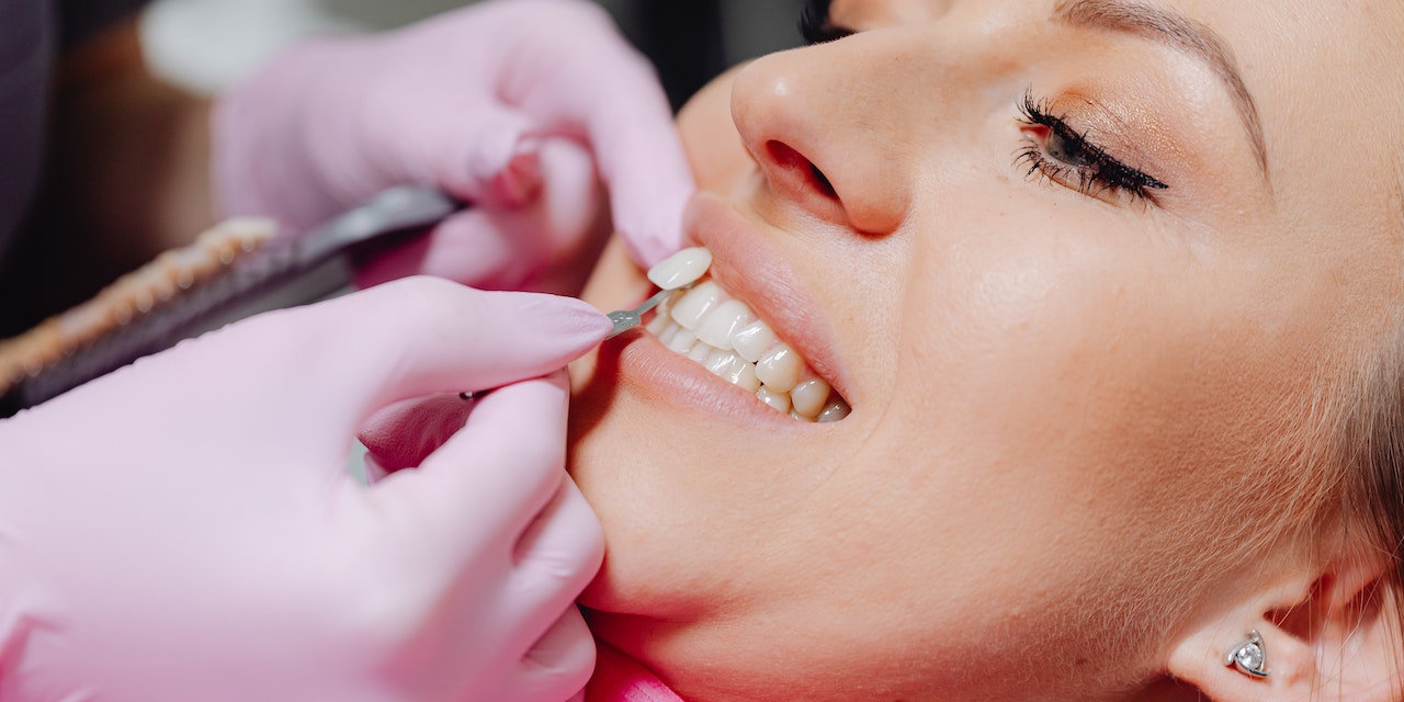 Bağcılar Zirkonyum Diş Uygulaması Nerede Yaptırılır?