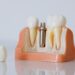 tum-disler-implant-olur-mu