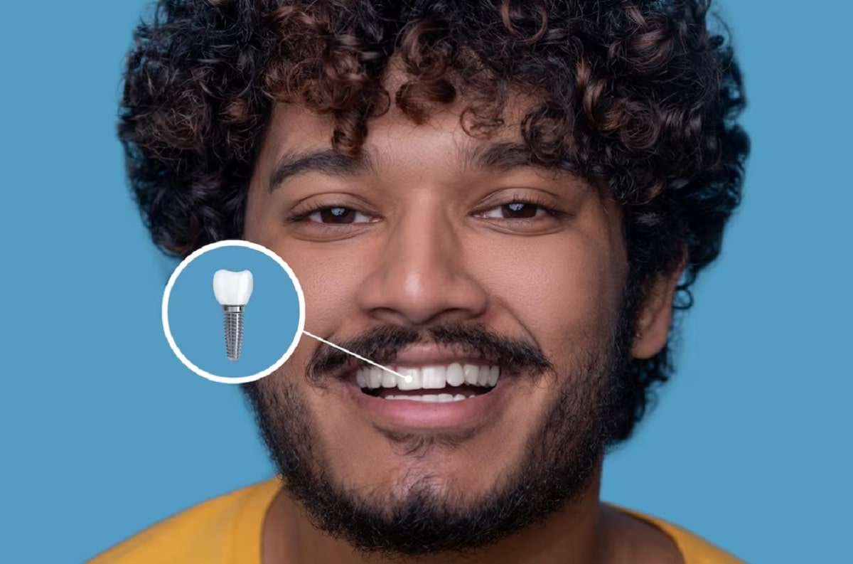 10 Adımda Dental İmplant Nedir? Avantajları Nelerdir?
