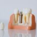 32-dis-implant-fiyatlari