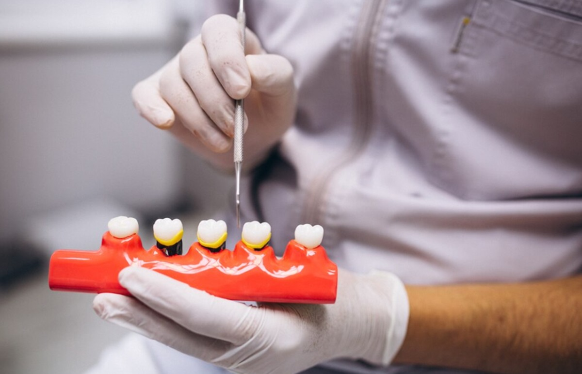 basarisiz-implant-belirtileri-nelerdir-