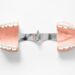 dikissiz-implant-nasil-yapilir-