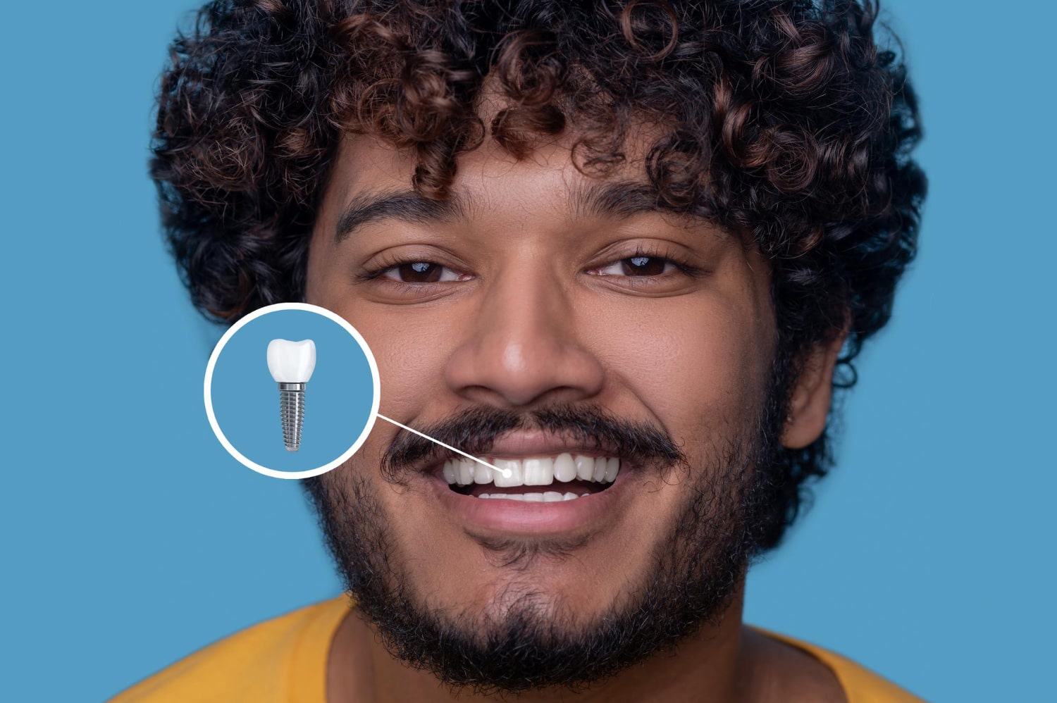 İstanbul’da Dental İmplant Tedavisi En Yakın Nerede Yapılır?